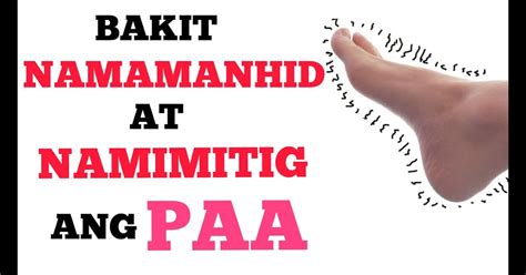 namaga ang paa in english|namamaga » Tagalog .